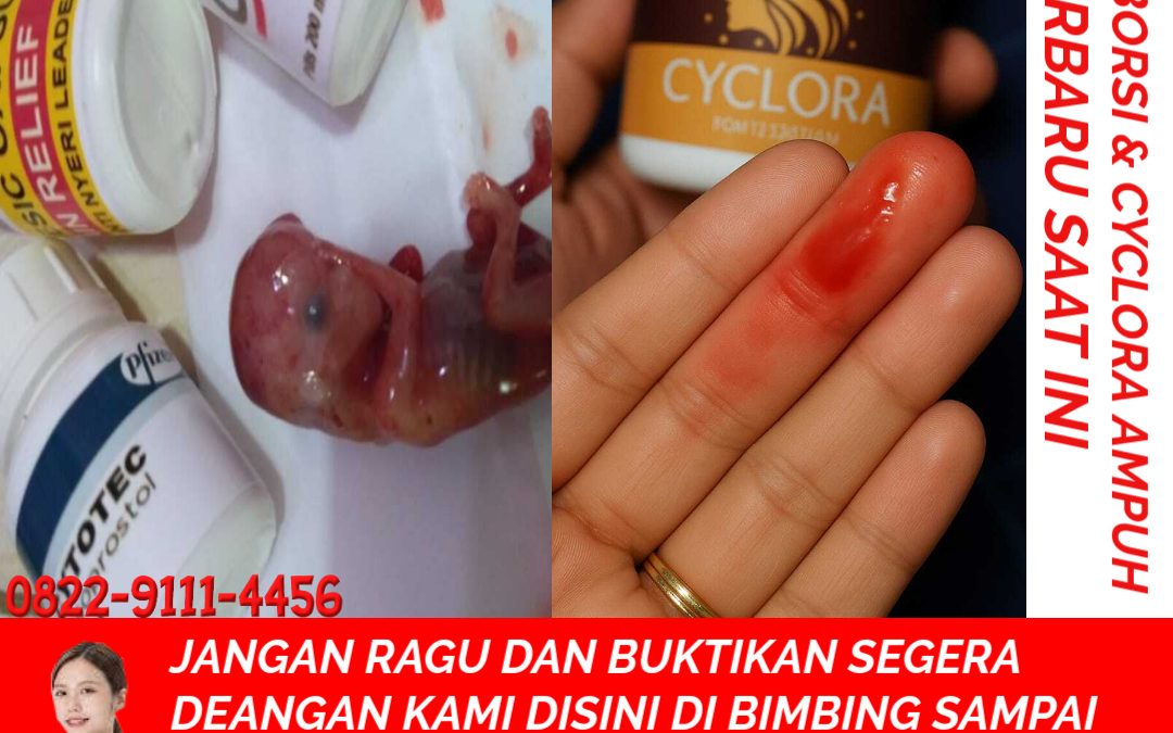 Jual Obat Aborsi Asli: Bisa COD / Bayar Ditempat, Ampuh, dan Aman Efek Samping
