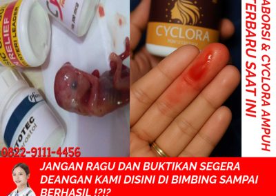 Jual Obat Aborsi Asli: Bisa COD / Bayar Ditempat, Ampuh, dan Aman Efek Samping